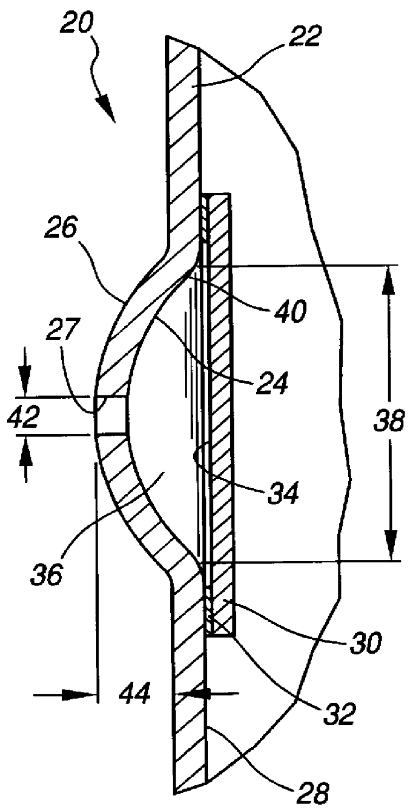 Tuned electromagnetic interference air filter