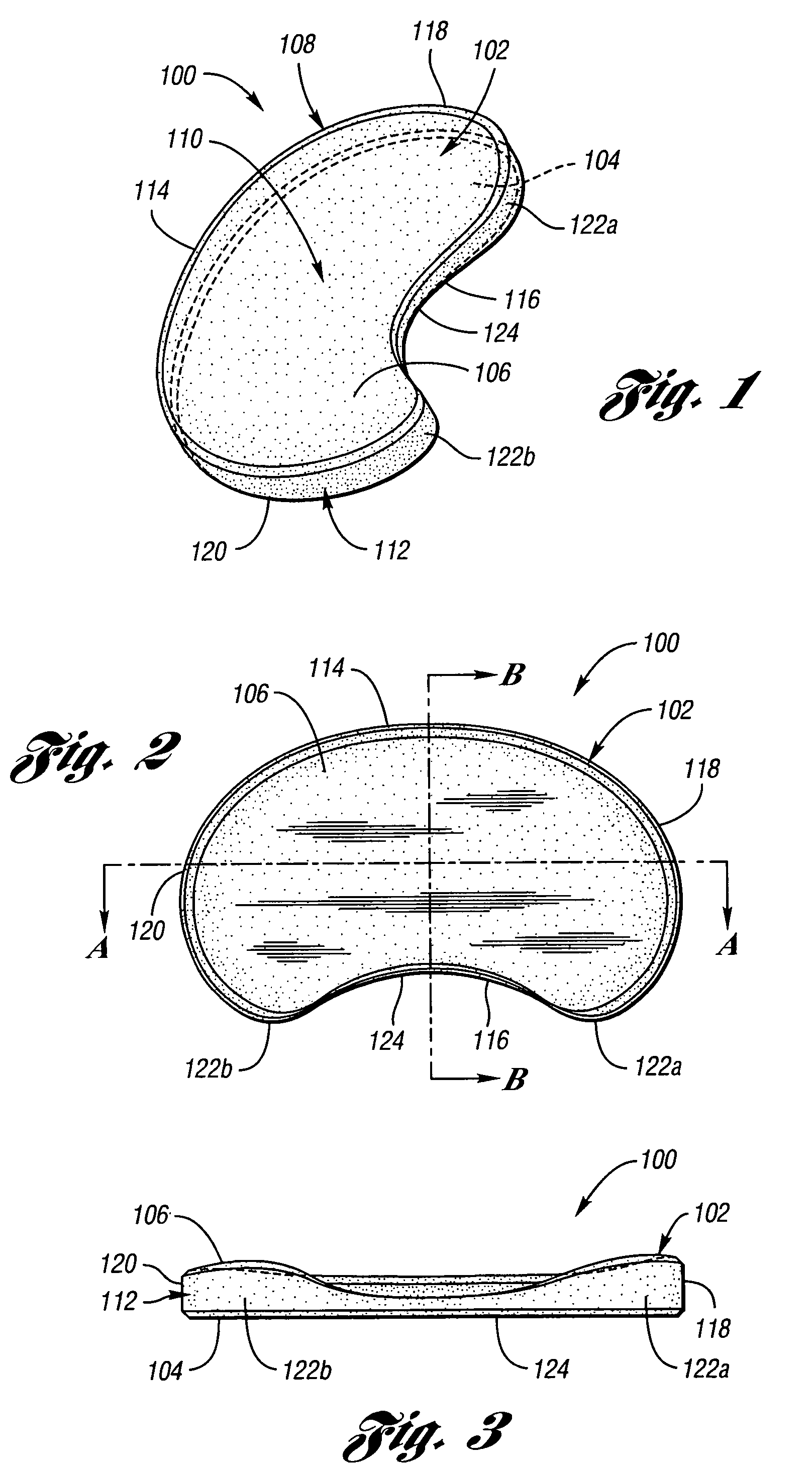 Surgically implantable knee prosthesis