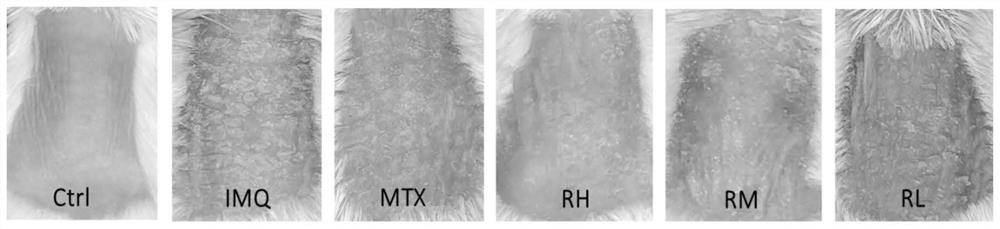 Pharmaceutical application of rhein as S100A8 inhibitor in inflammatory diseases