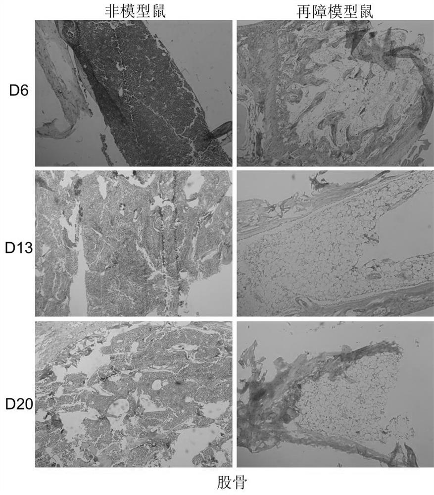 Application of irisin in the preparation of medicine for the treatment of aplastic anemia