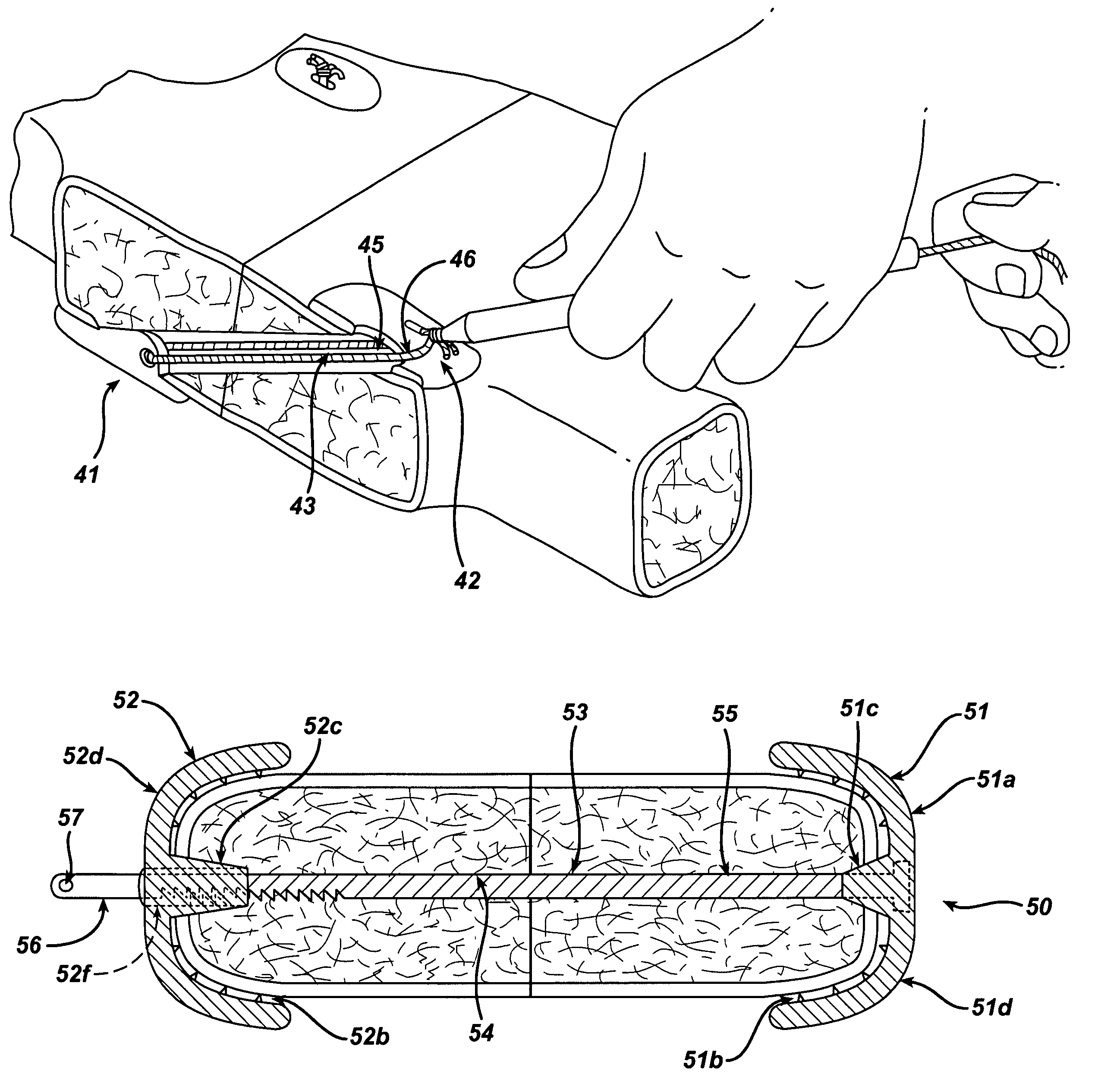 Sternal closure device and method