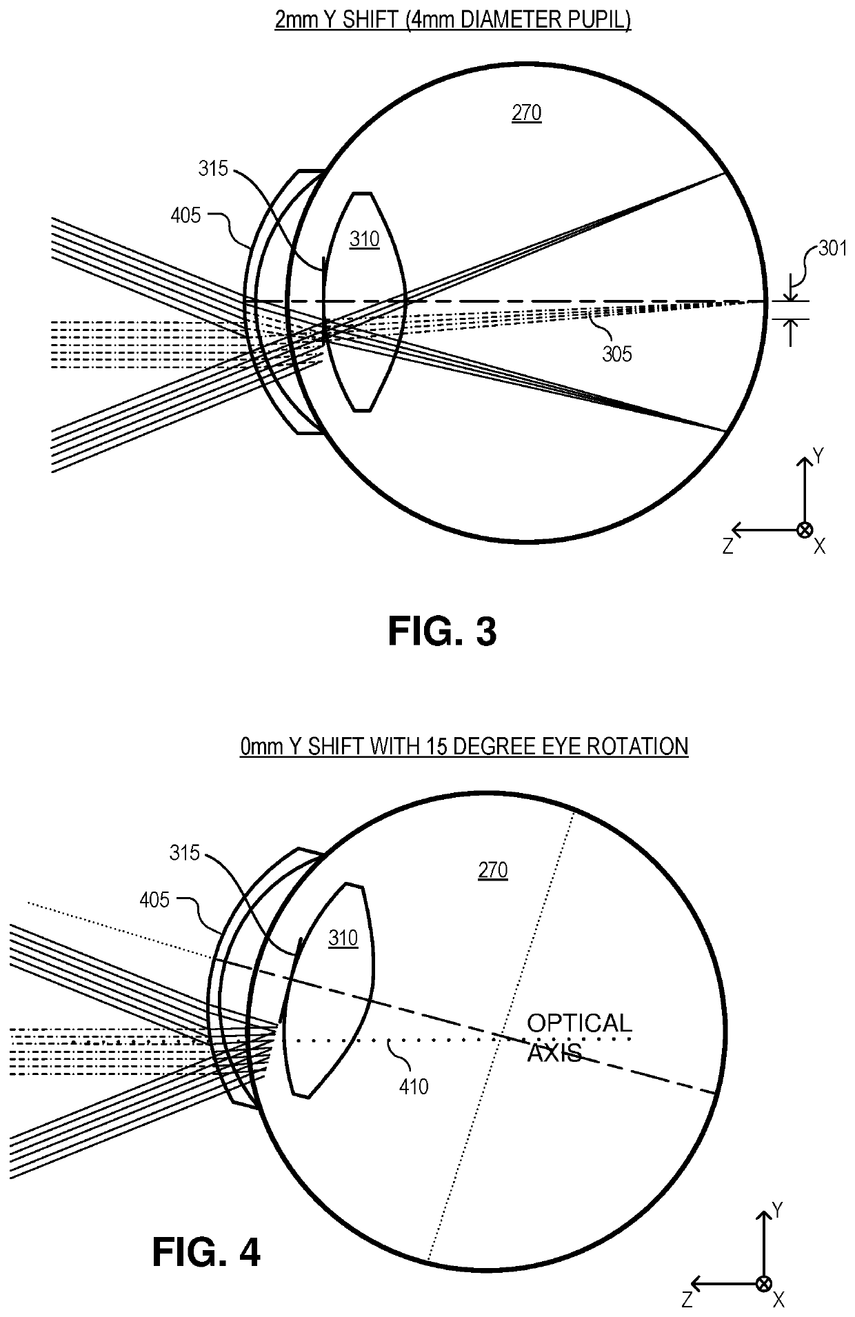 Dynamic eye fixation for retinal imaging