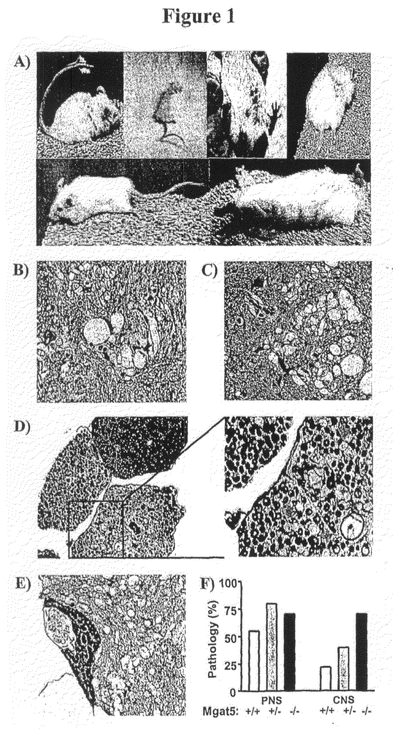 Methods and compositions for preventing and treating a disease related to glycan dysregulation