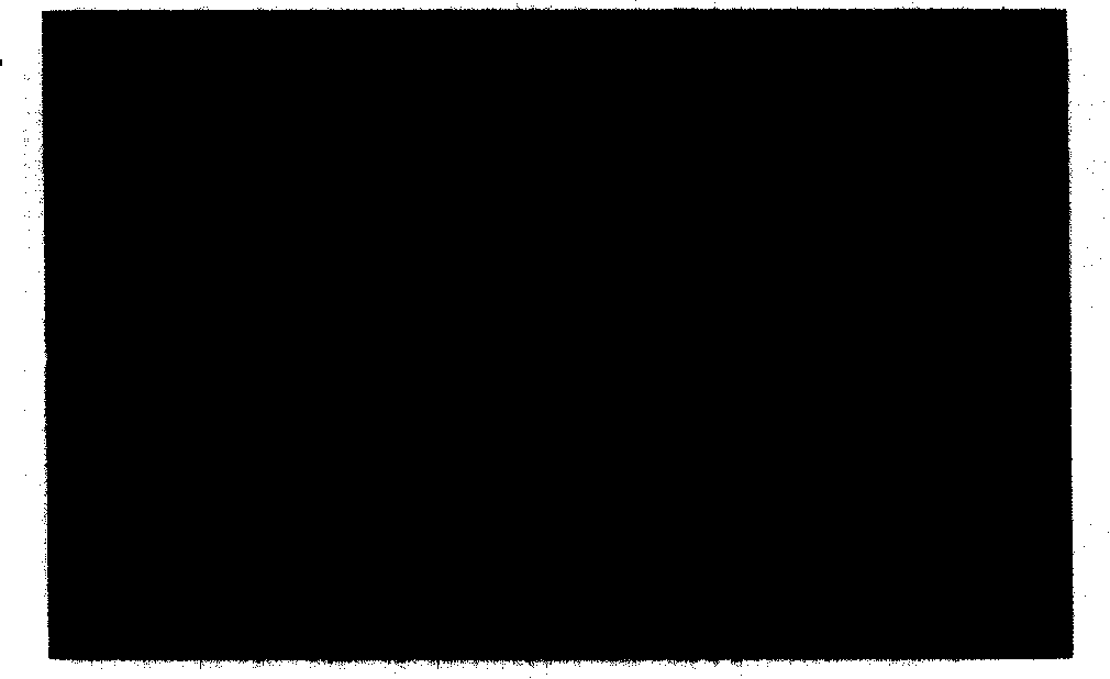 Subtype detection method and reagent kit for hepatitis B virogene