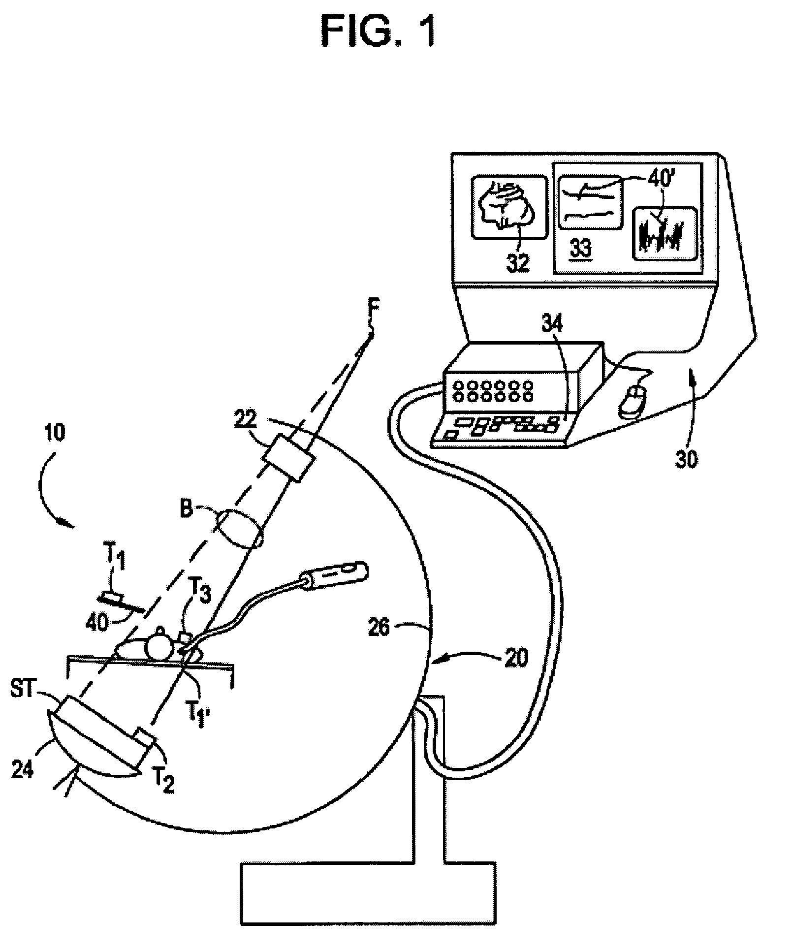 Method and system for improved correction of registration error in a fluoroscopic image