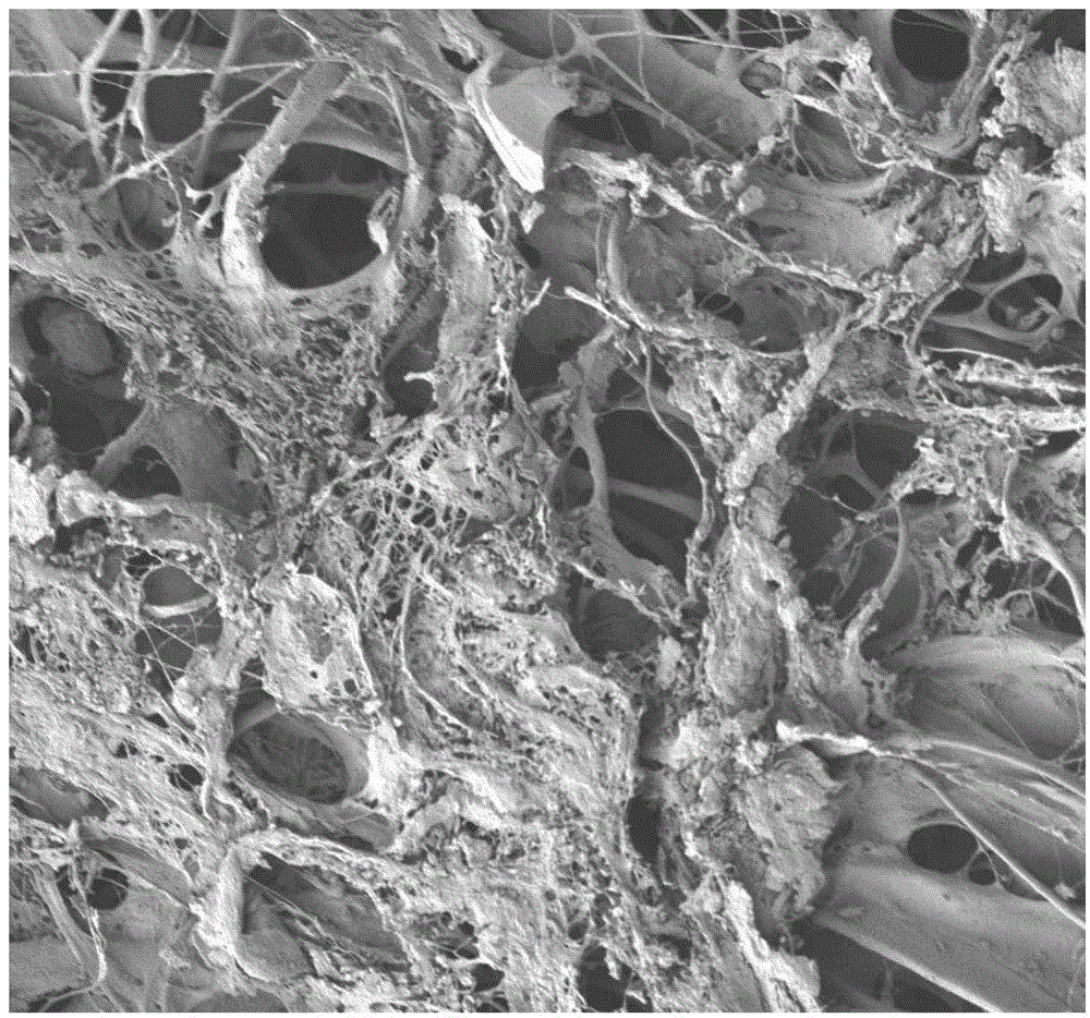 Acellular polysaccharide dermal matrix materials and production method and application thereof