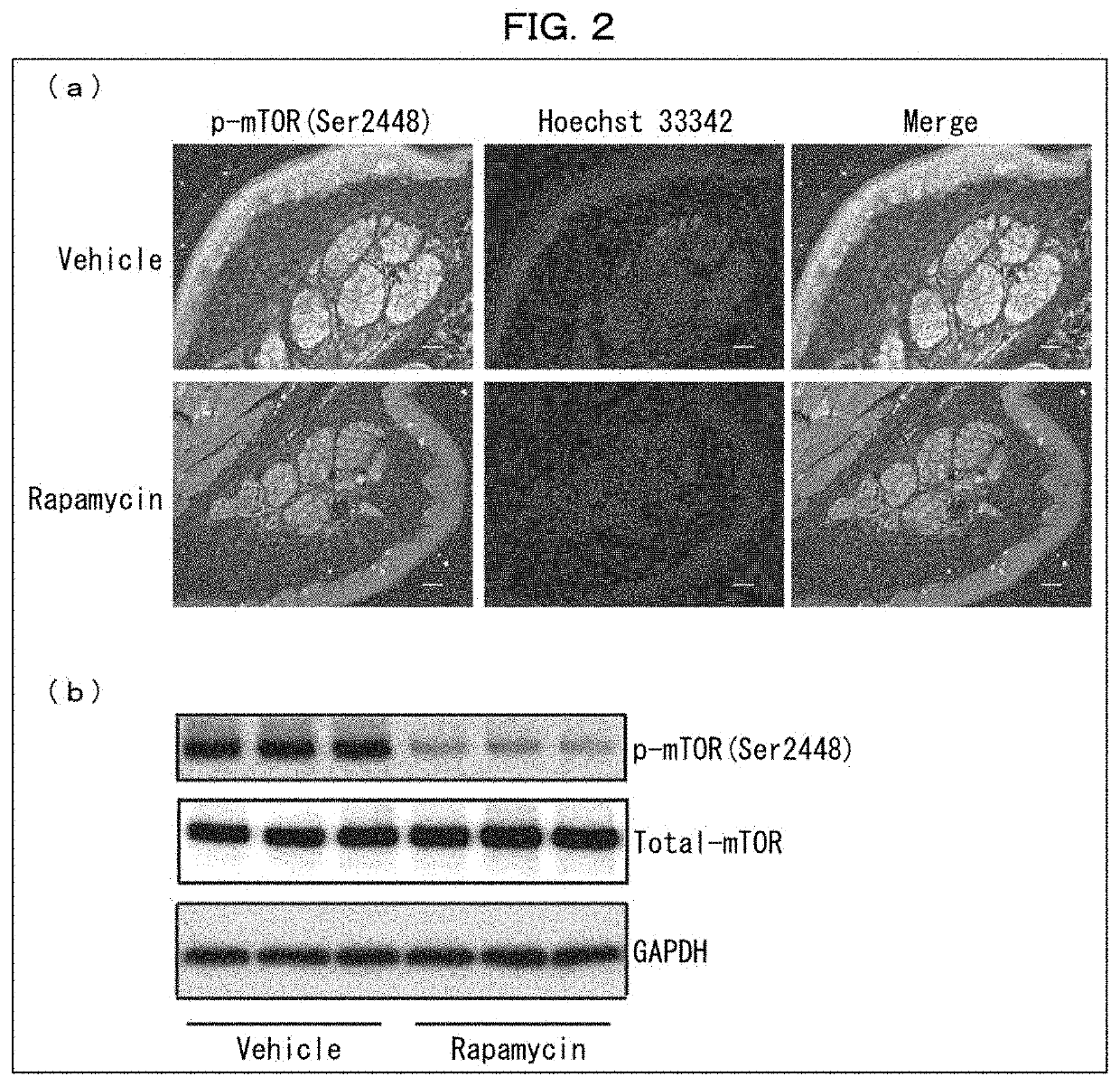 Agent for treating fabry disease, analgesic for external use and perspiration accelerator