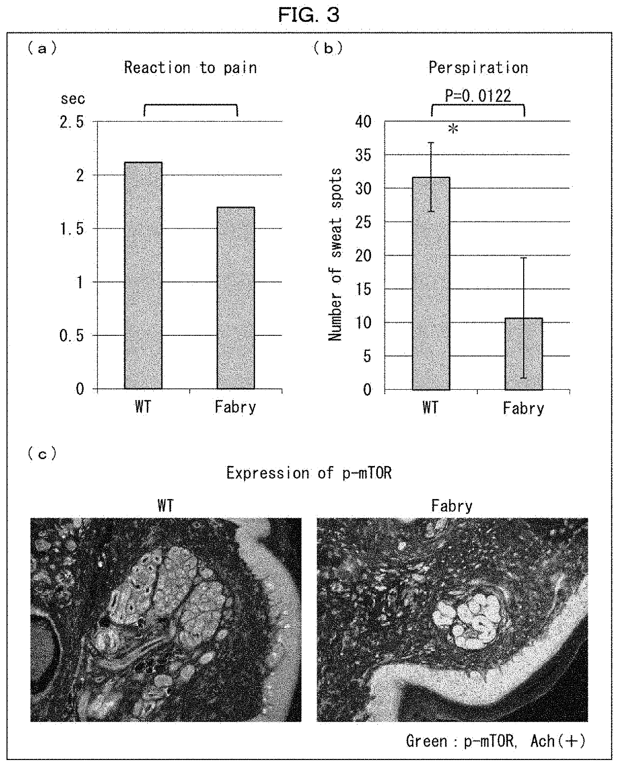 Agent for treating fabry disease, analgesic for external use and perspiration accelerator