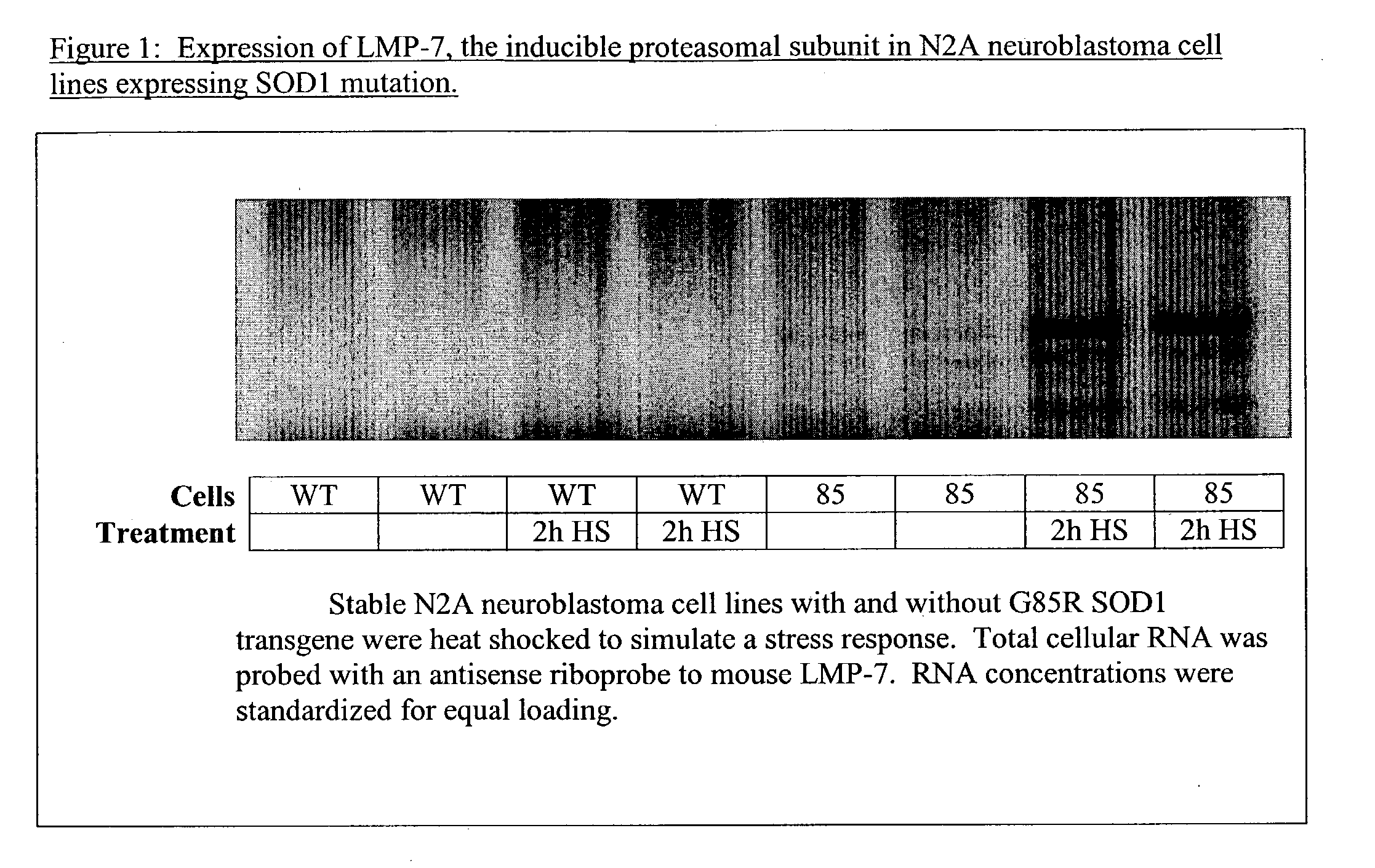 Treatment of neurodegenerative diseases using proteasome modulators