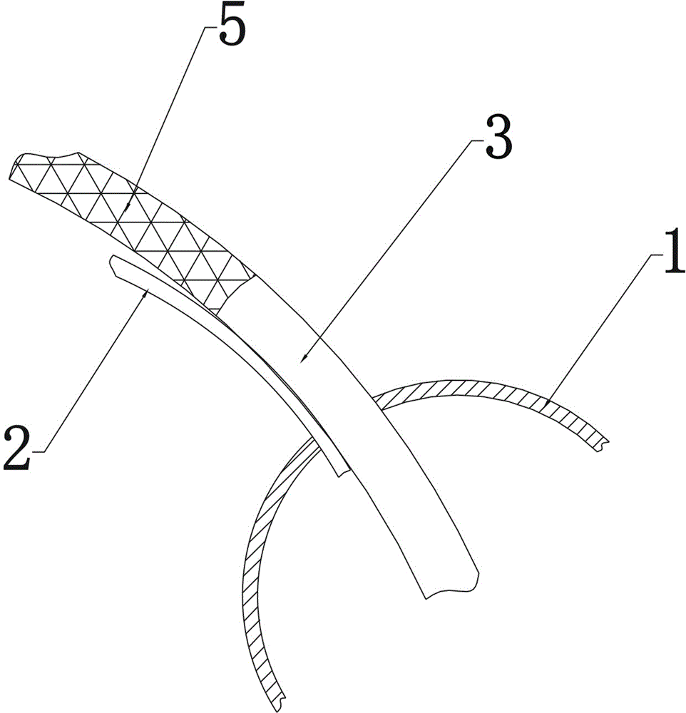 Antegrade aorta infusion tube having internal blocking function, application and usage method