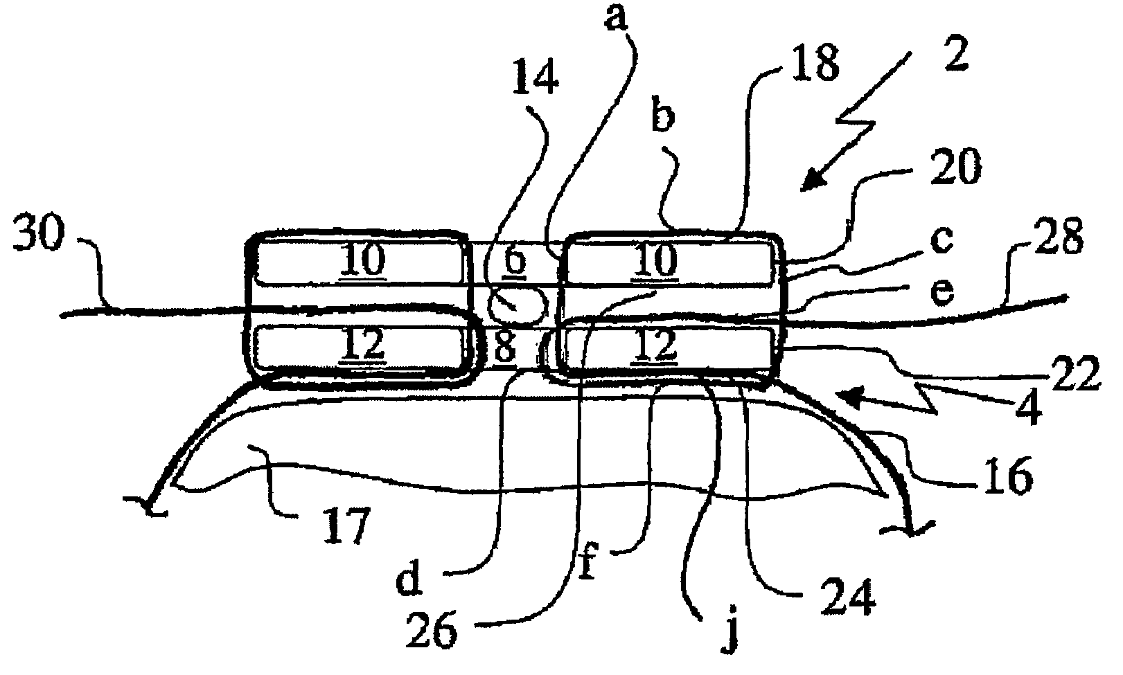 Bone fixing device