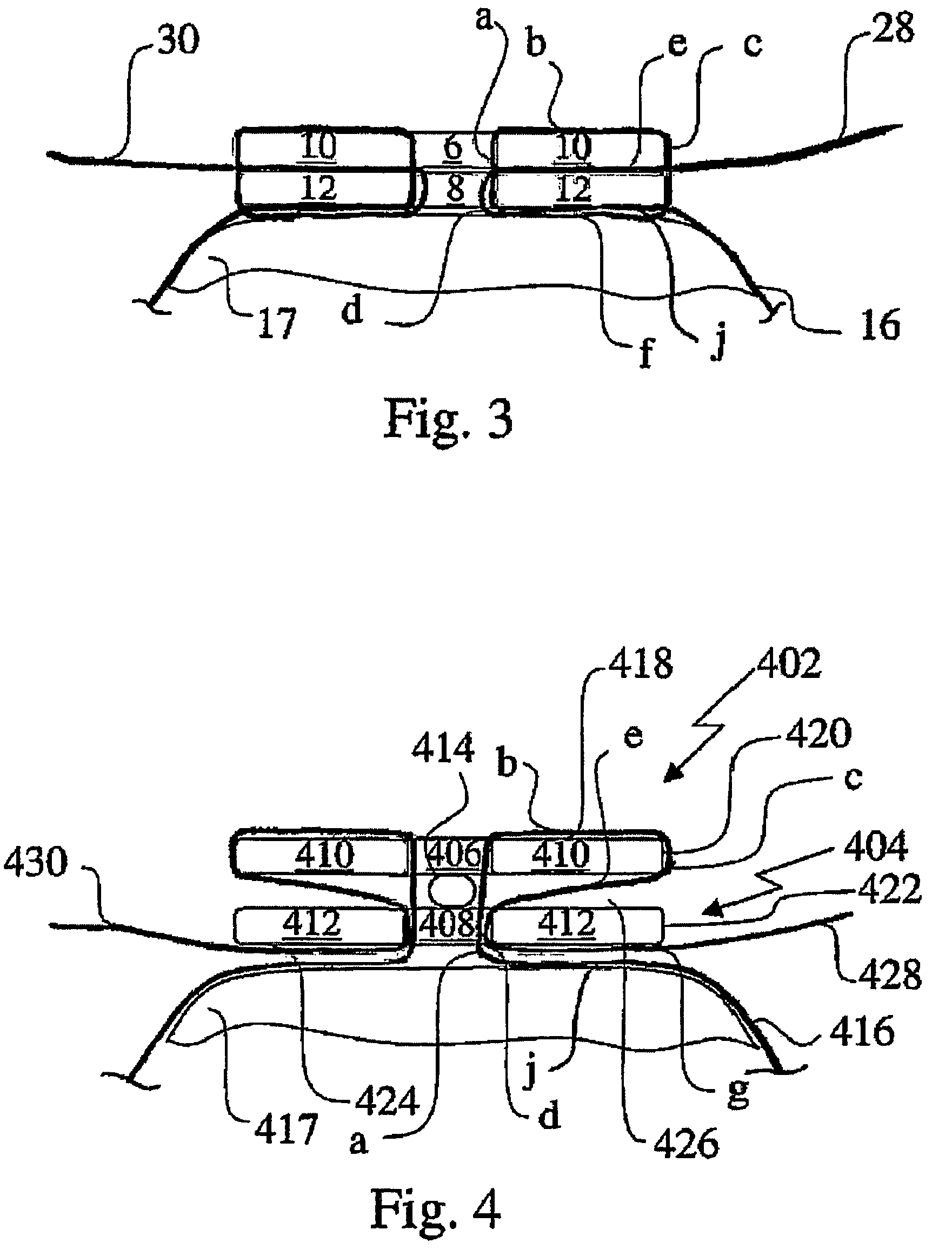 Bone fixing device