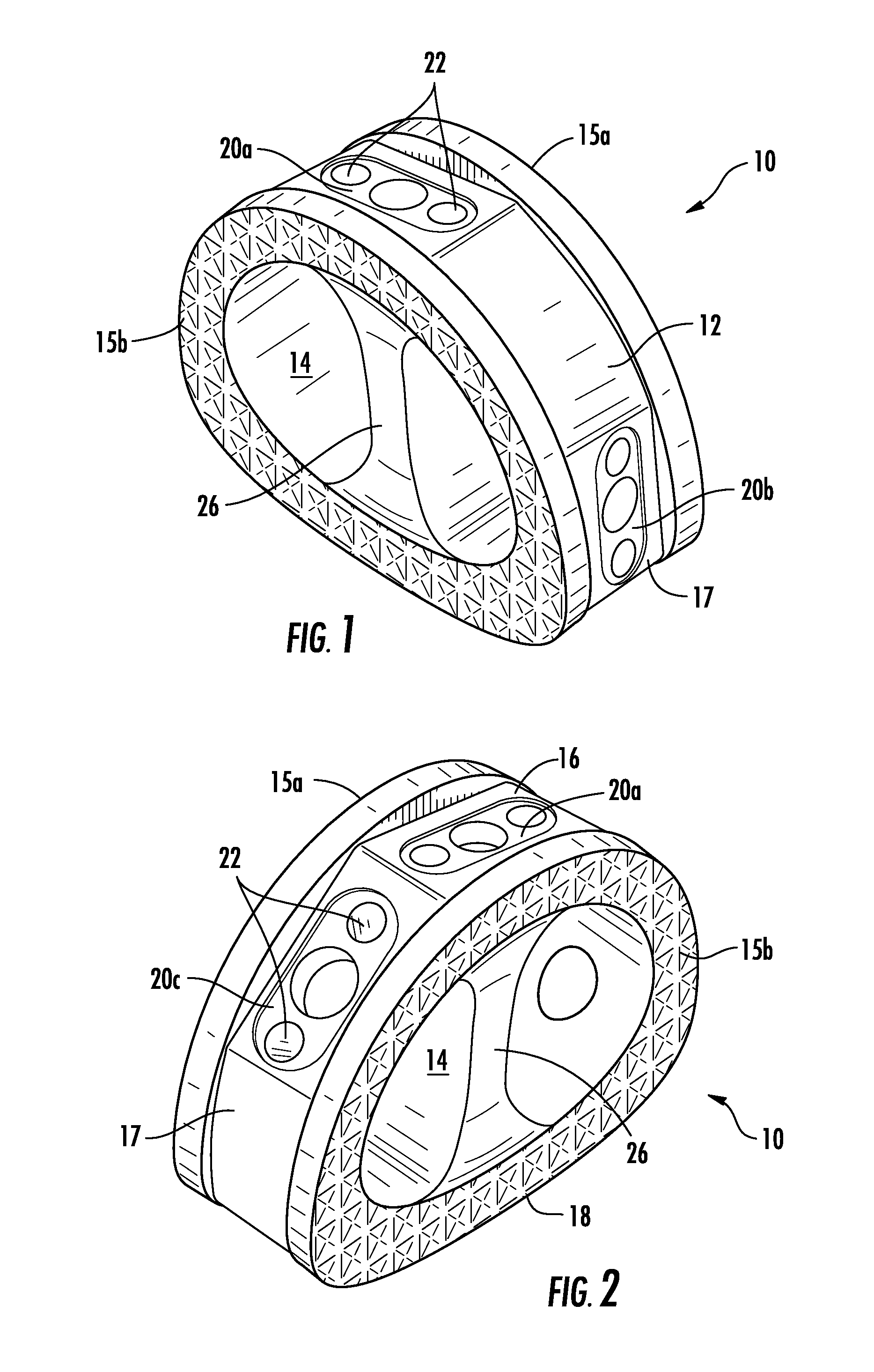 ALIF Spinal Cage