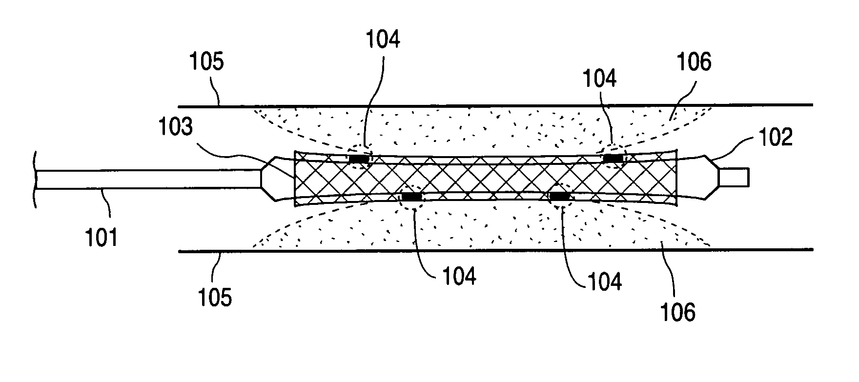 Compositions containing fast-leaching plasticizers for improved performance of medical devices