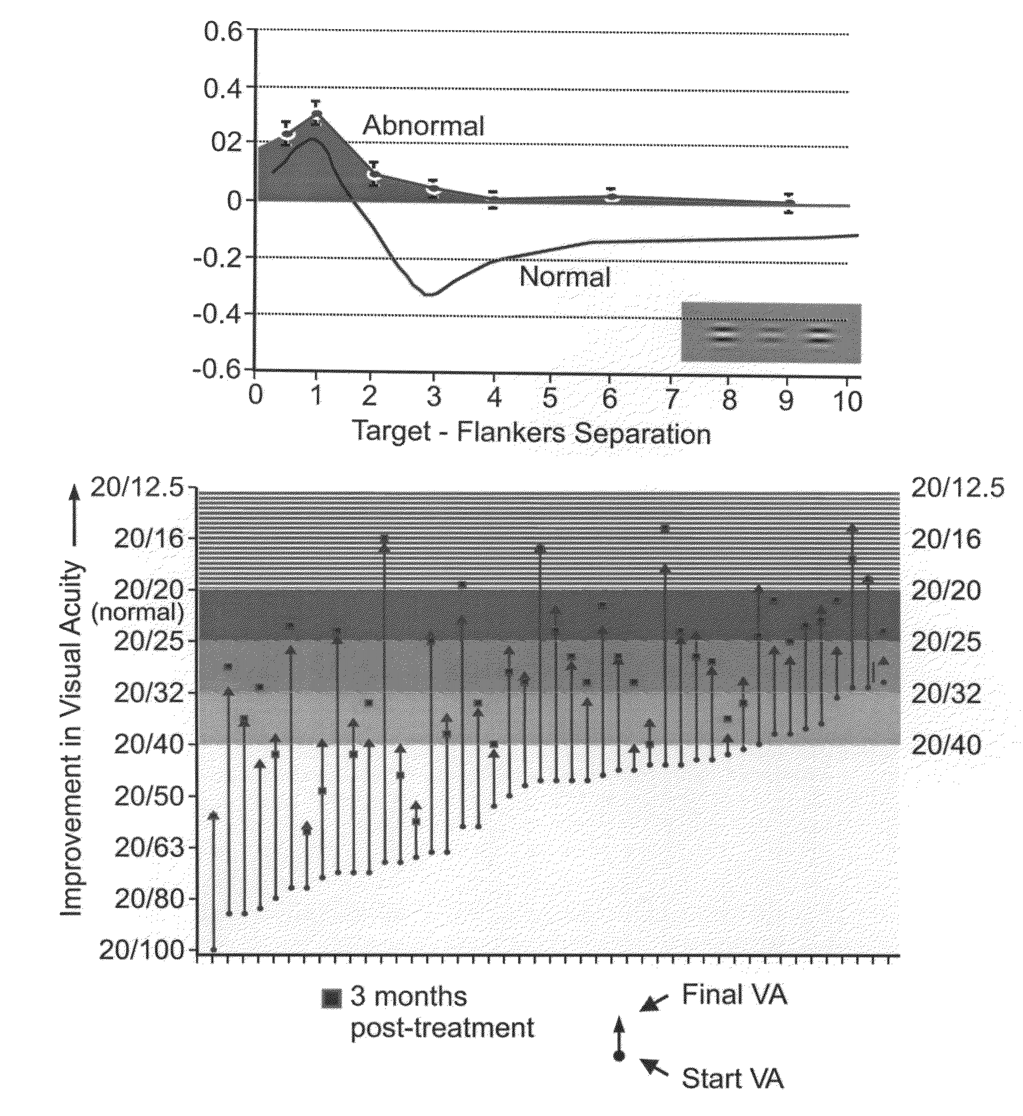 Method and apparatus for improving visual perception