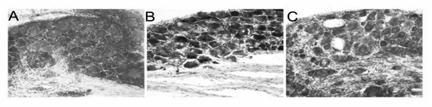 Tube pressing-type chronic nerve root injury model in animal and constructing method and application thereof