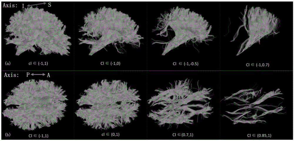 Interactive brain fiber selection and visualization method