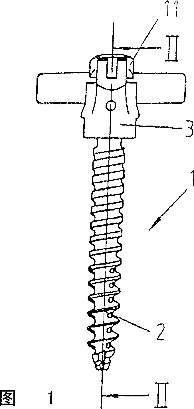 Embedded screw