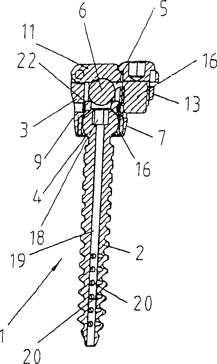 Embedded screw