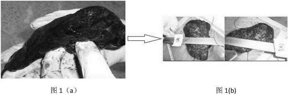 PET/CT macroscopical digital information and pathological microscopic information matching method