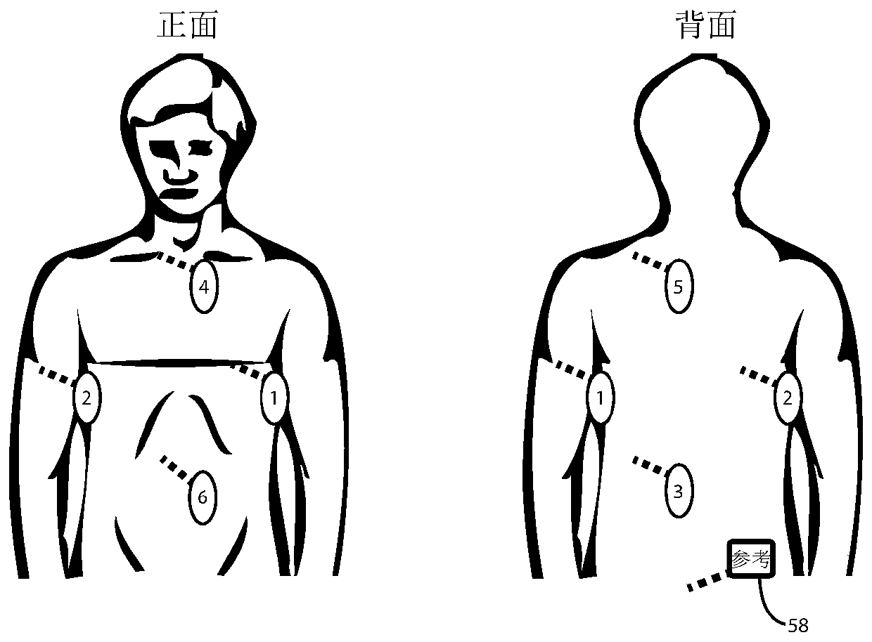 Cardiac mapping system with efficiency algorithm