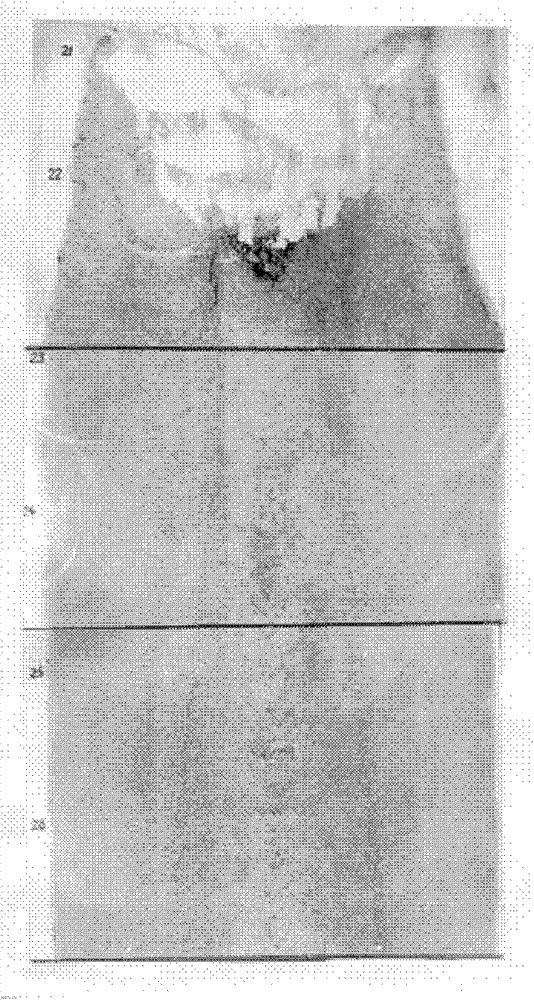 Method for effectively eliminating central defect of solidification blank and refining solidification structure