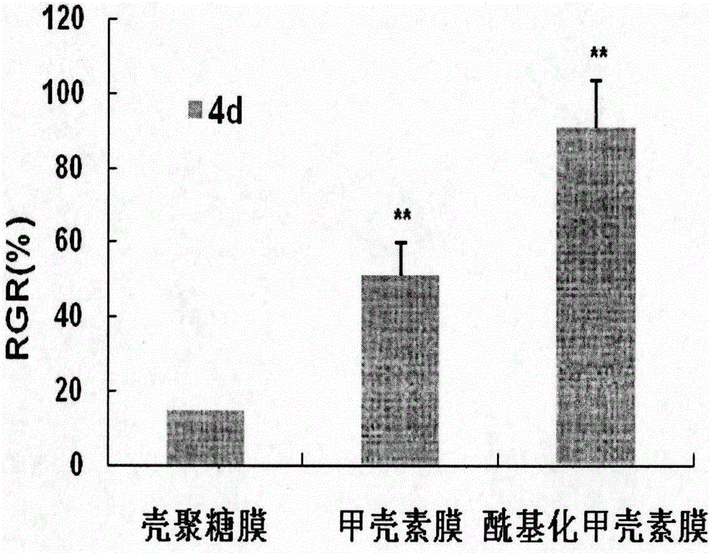 Lumen stent capable of conducting development absorption and preparation method and application thereof