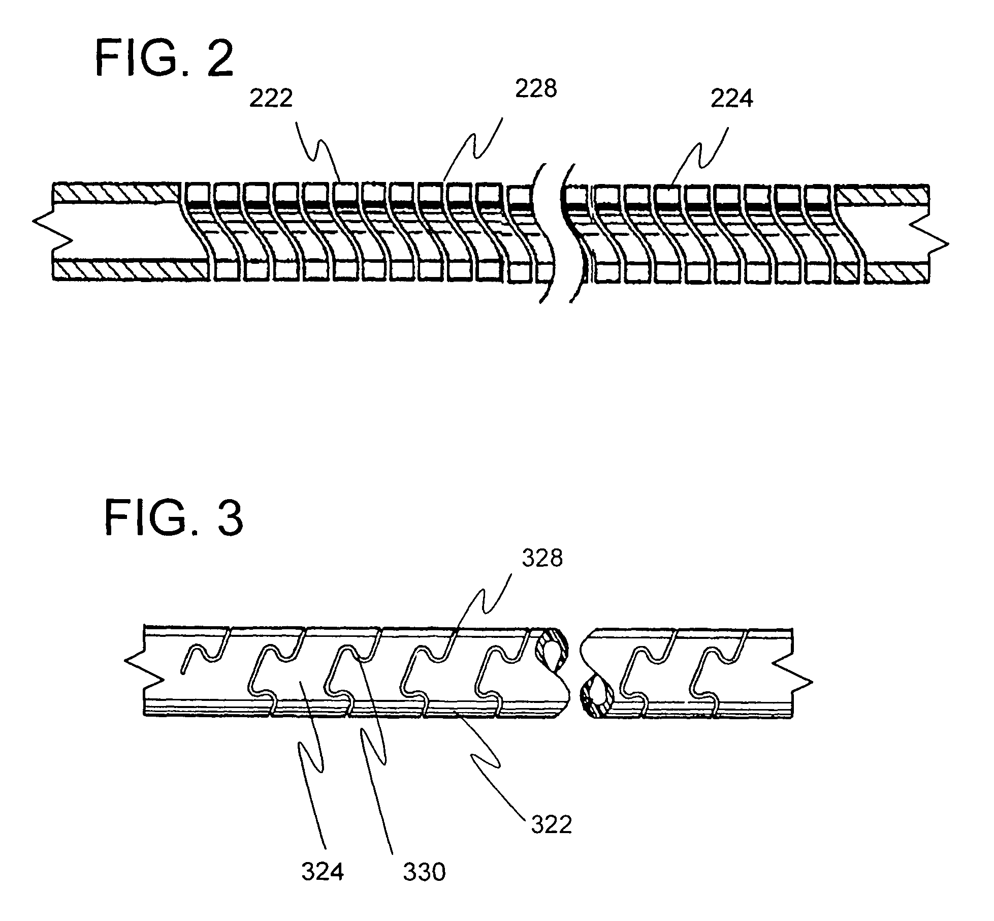 Flexible trephine and method of removing a bowed implant from a bone