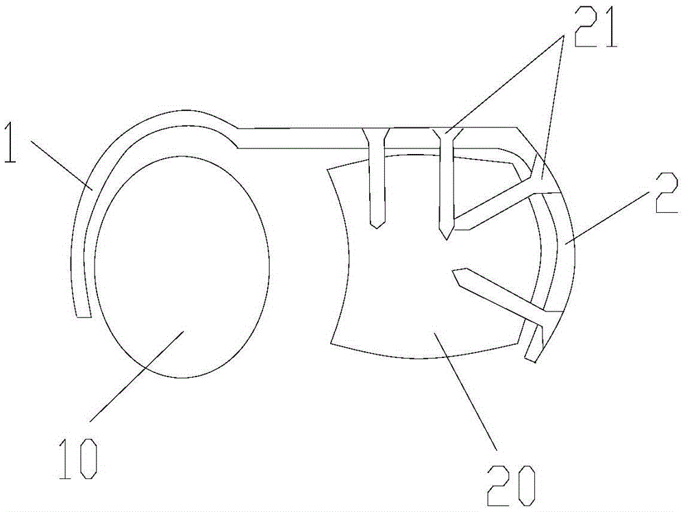 Lower radioulnar joint reduction and fixation plate