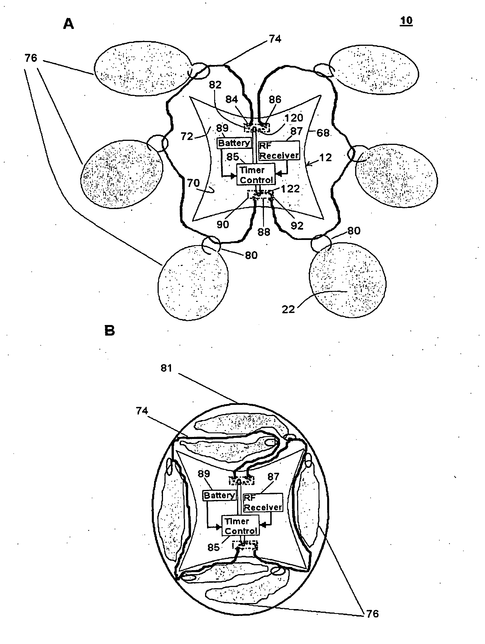 Controlled degradation of expandable polymers in gastric volume reduction treatment