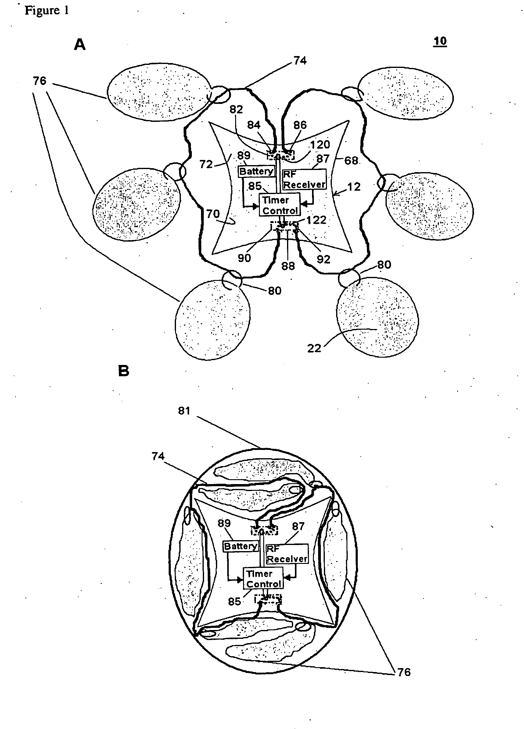 Controlled degradation of expandable polymers in gastric volume reduction treatment