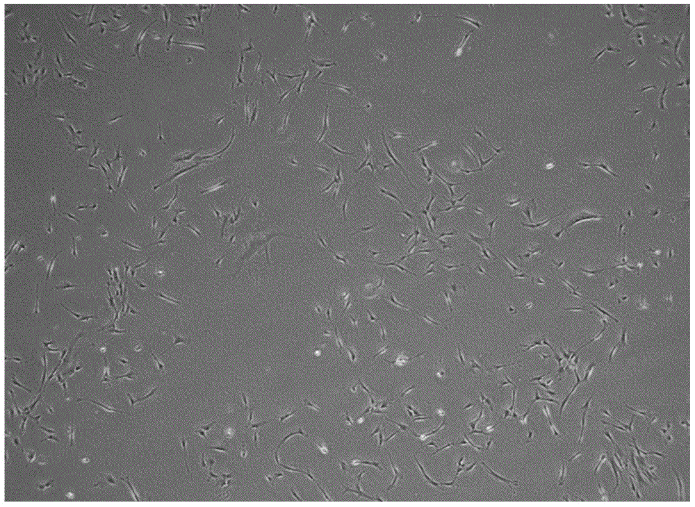 Method for preparing dental pulp mesenchymal stem cells and establishing dental pulp mesenchymal stem cell bank and cell resuscitation method