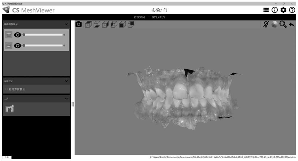 Manufacturing method of digital 3D printing soft elastic tooth protector