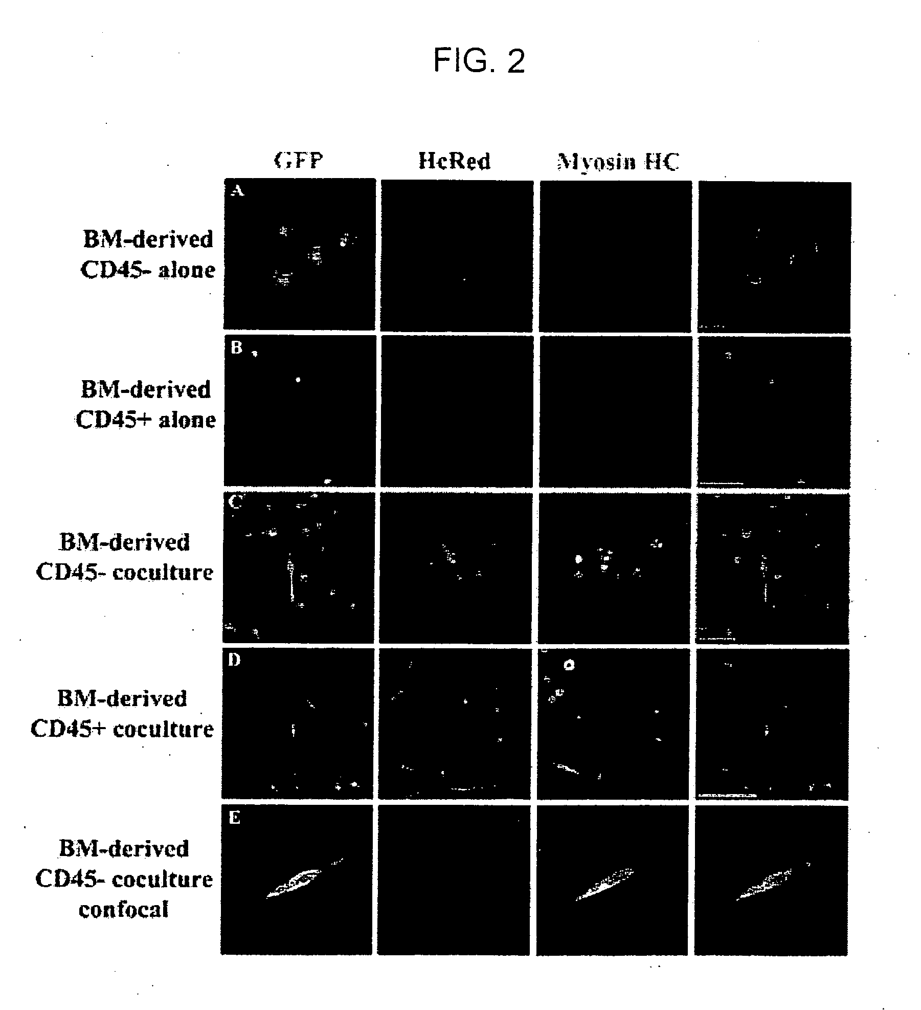 Isolation and characterization of muscle regenerating cells