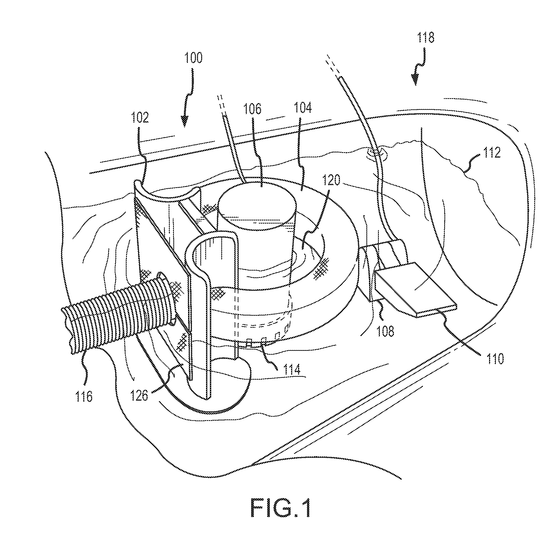 Water pollution prevention and remediation apparatus