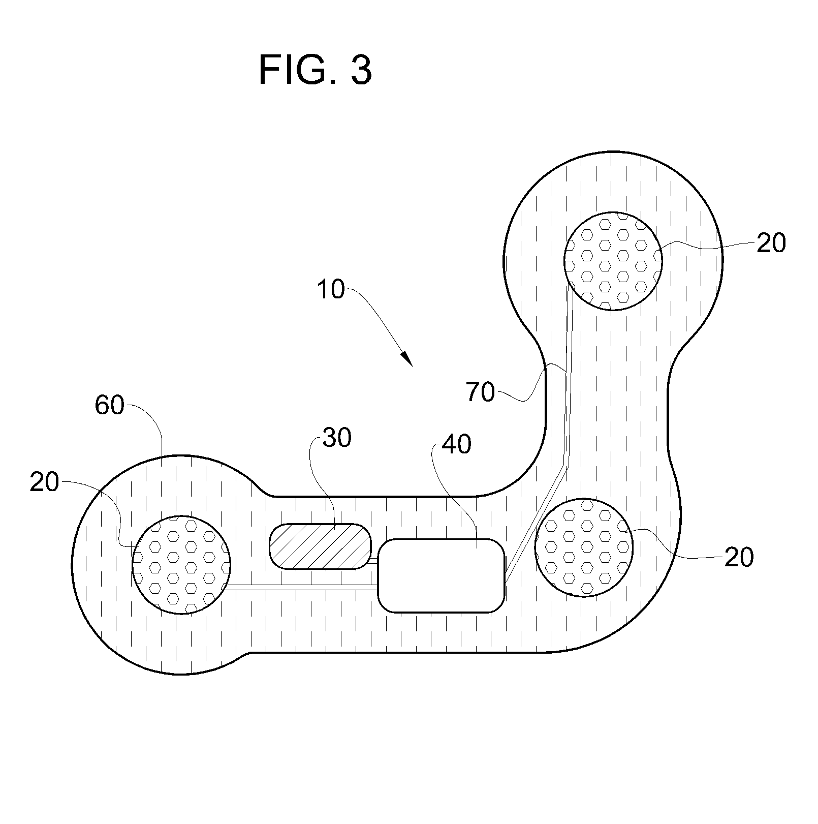 Heart monitoring body patch and system