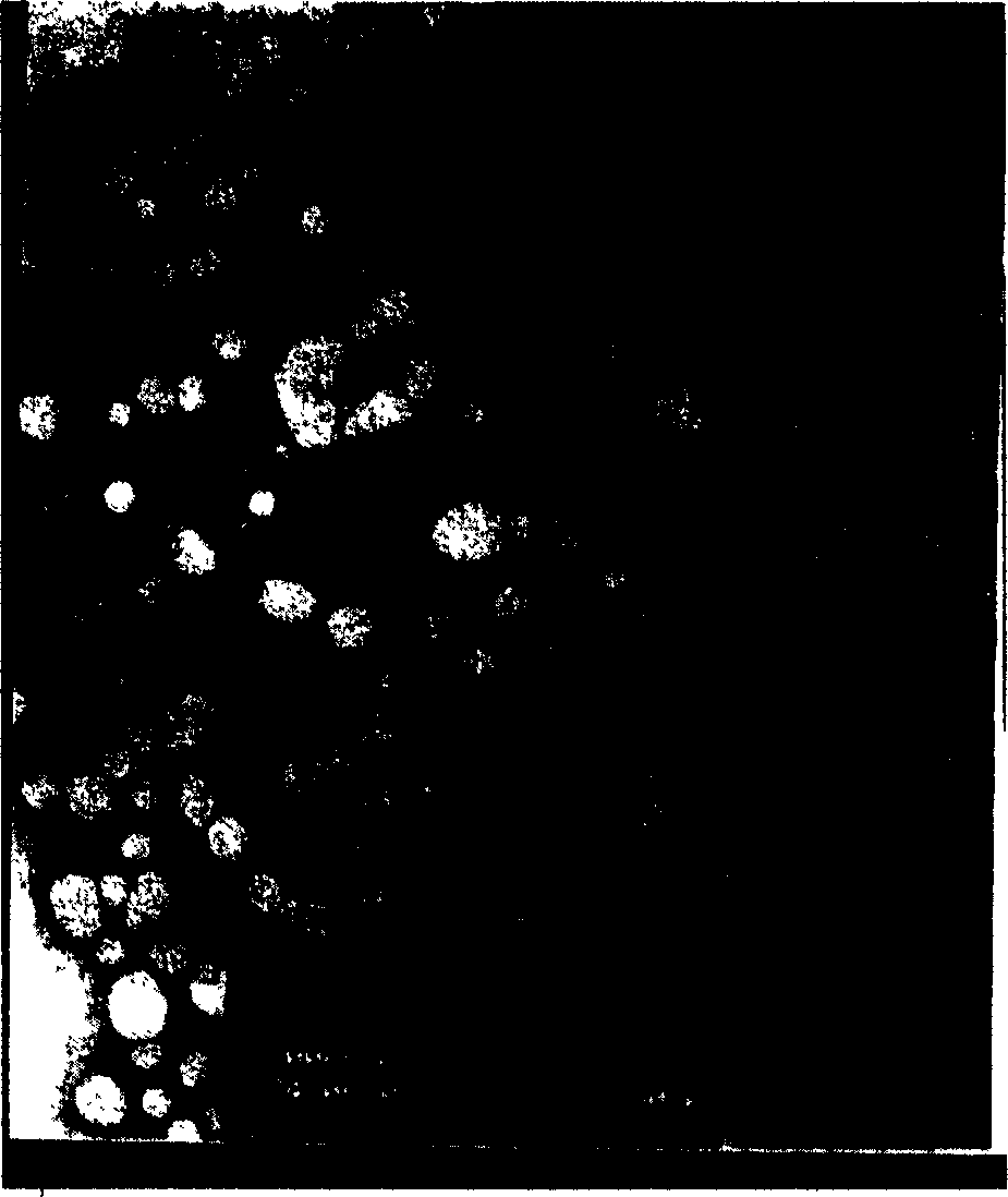 Silymarin behenic acid glyceride lipid nano particle oral solution dosage and its preparation method