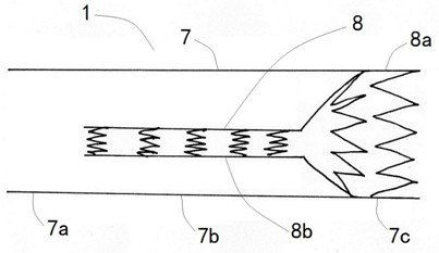 A combined device for reconstructing aortic arch and three-branch covered stent graft