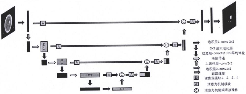 Intracranial hemorrhage segmentation method fusing dense connection and attention mechanism