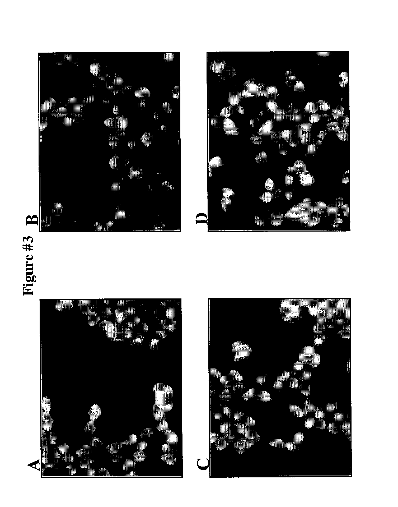 Protein fragment complementation assay (PCA) for the detection of protein-protein, protein-small molecule and protein nucleic acid interactions based on the E. coli TEM-1 beta-lactamase