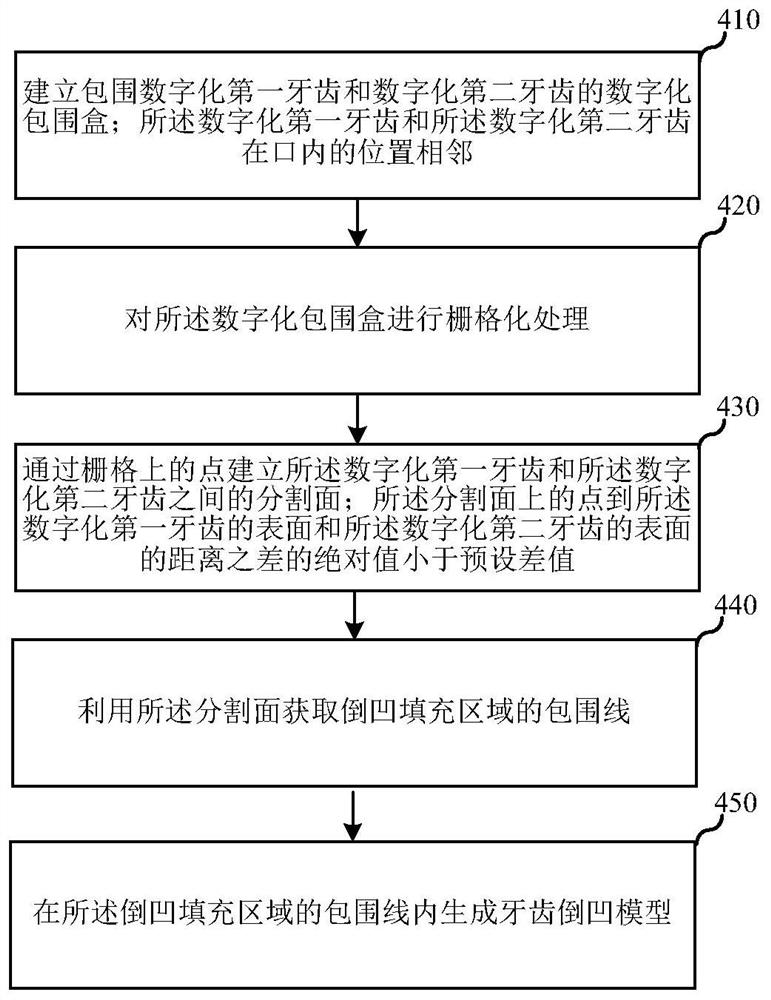 Preparation method of shell-shaped dental appliance