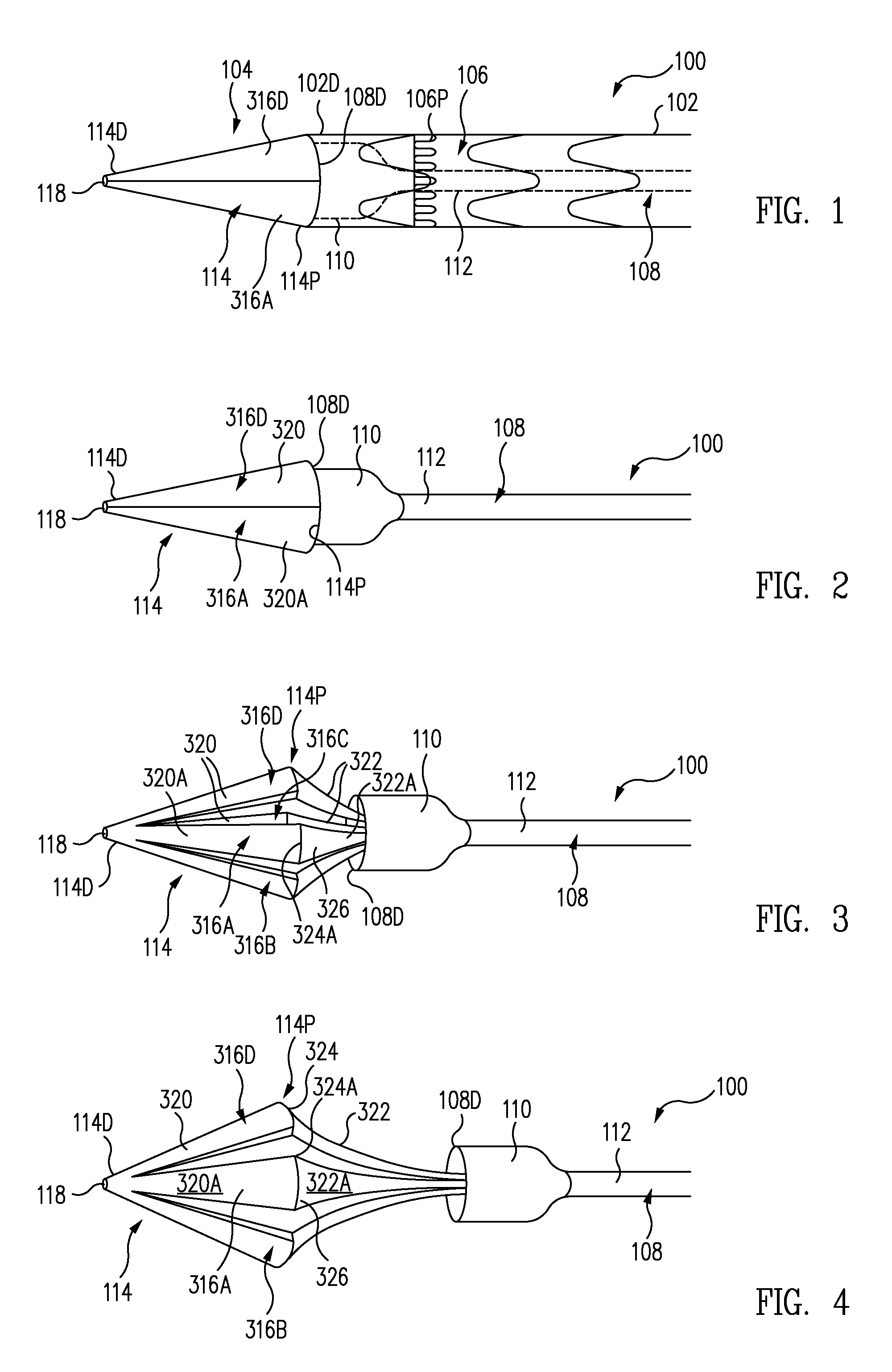 Expandable tip delivery system and method