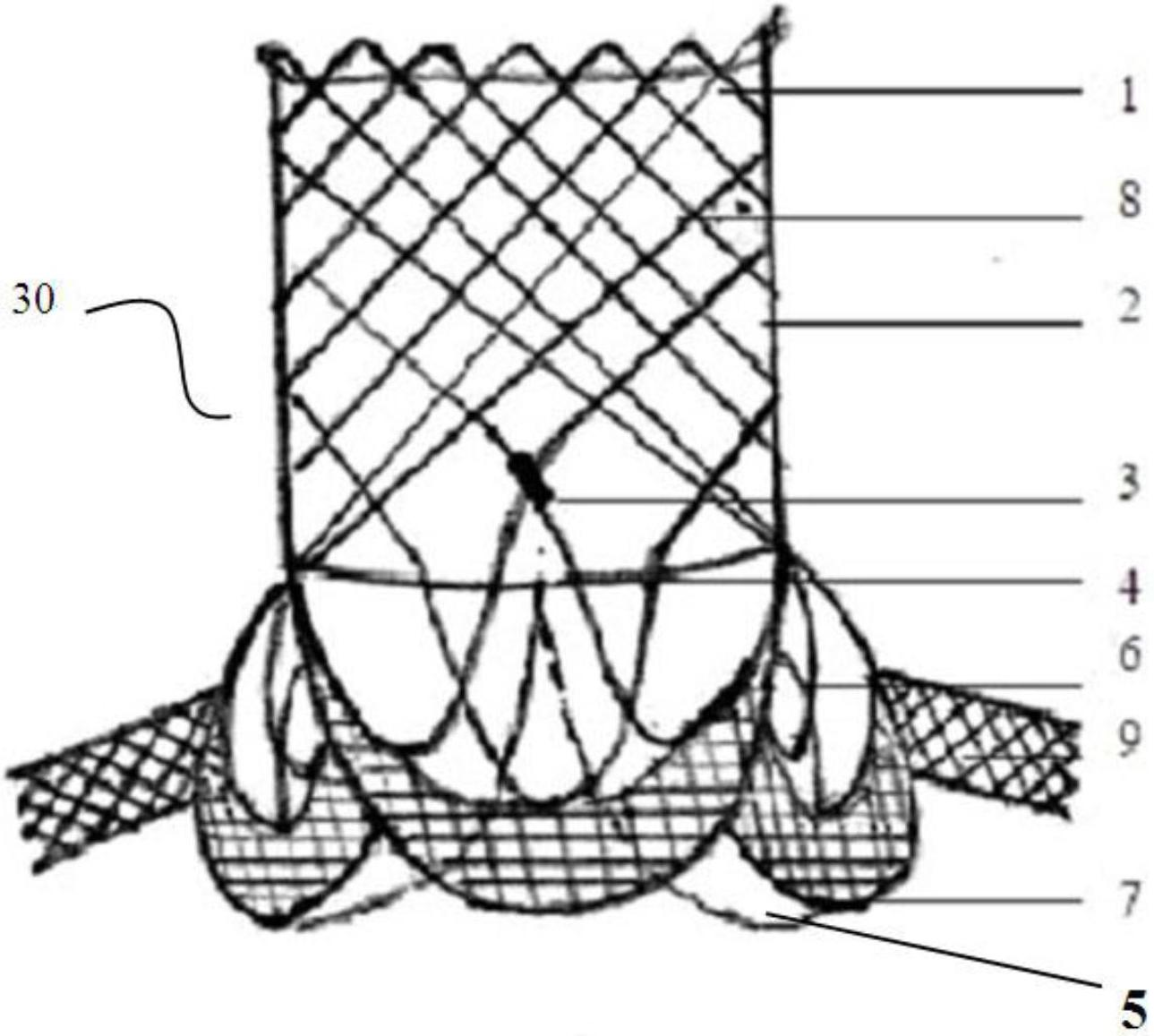 Aortic valve stent with coronary artery and conveyor of same