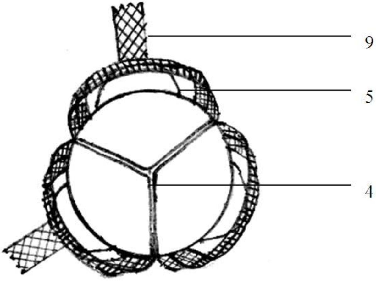 Aortic valve stent with coronary artery and conveyor of same