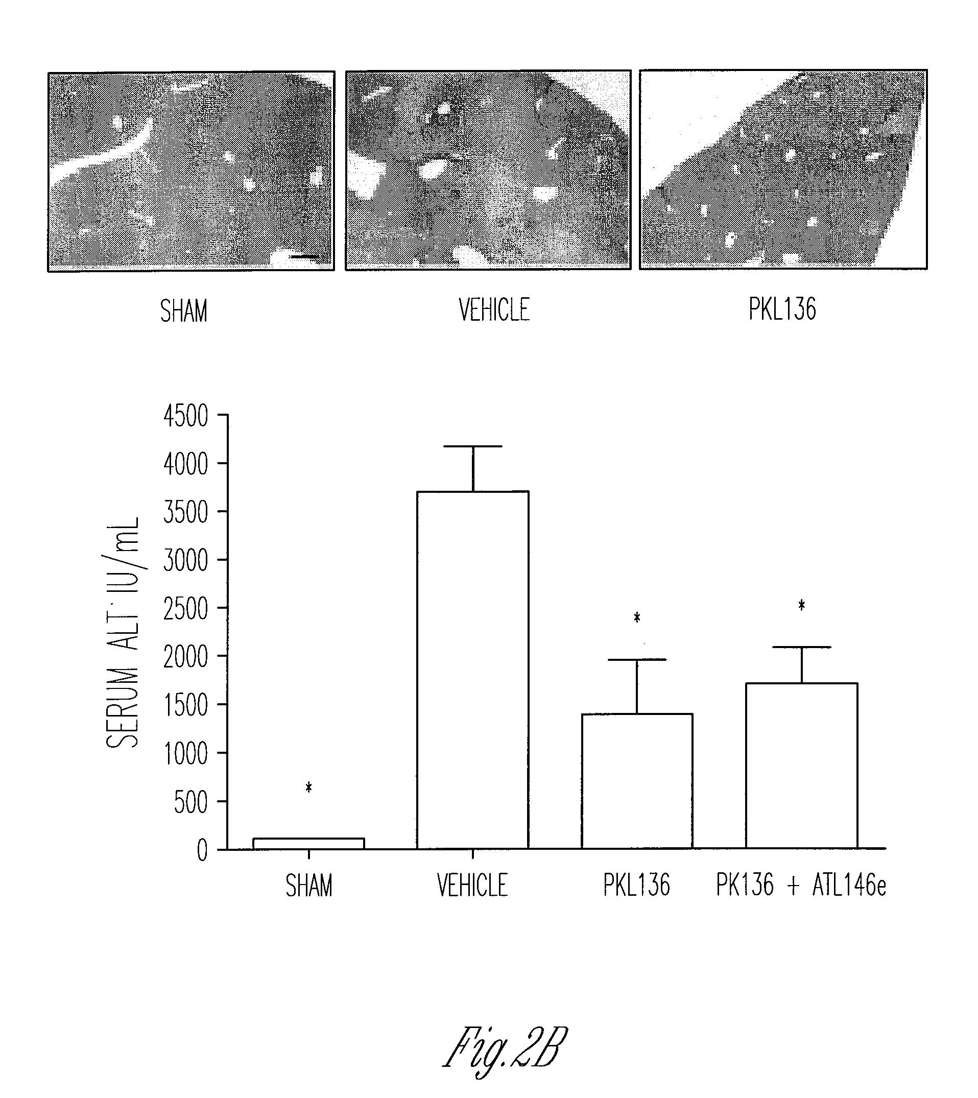 Method of treating ischemia reperfusion injury by inhibiting NKT cell activity