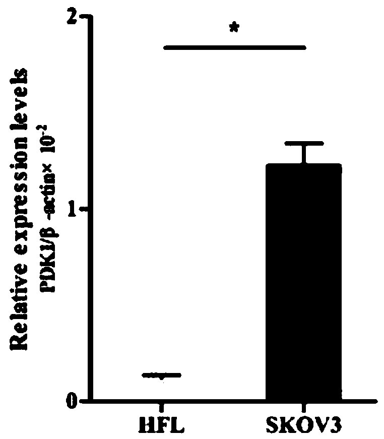 Ovarian cancer diagnosis or prognosis composition and application thereof