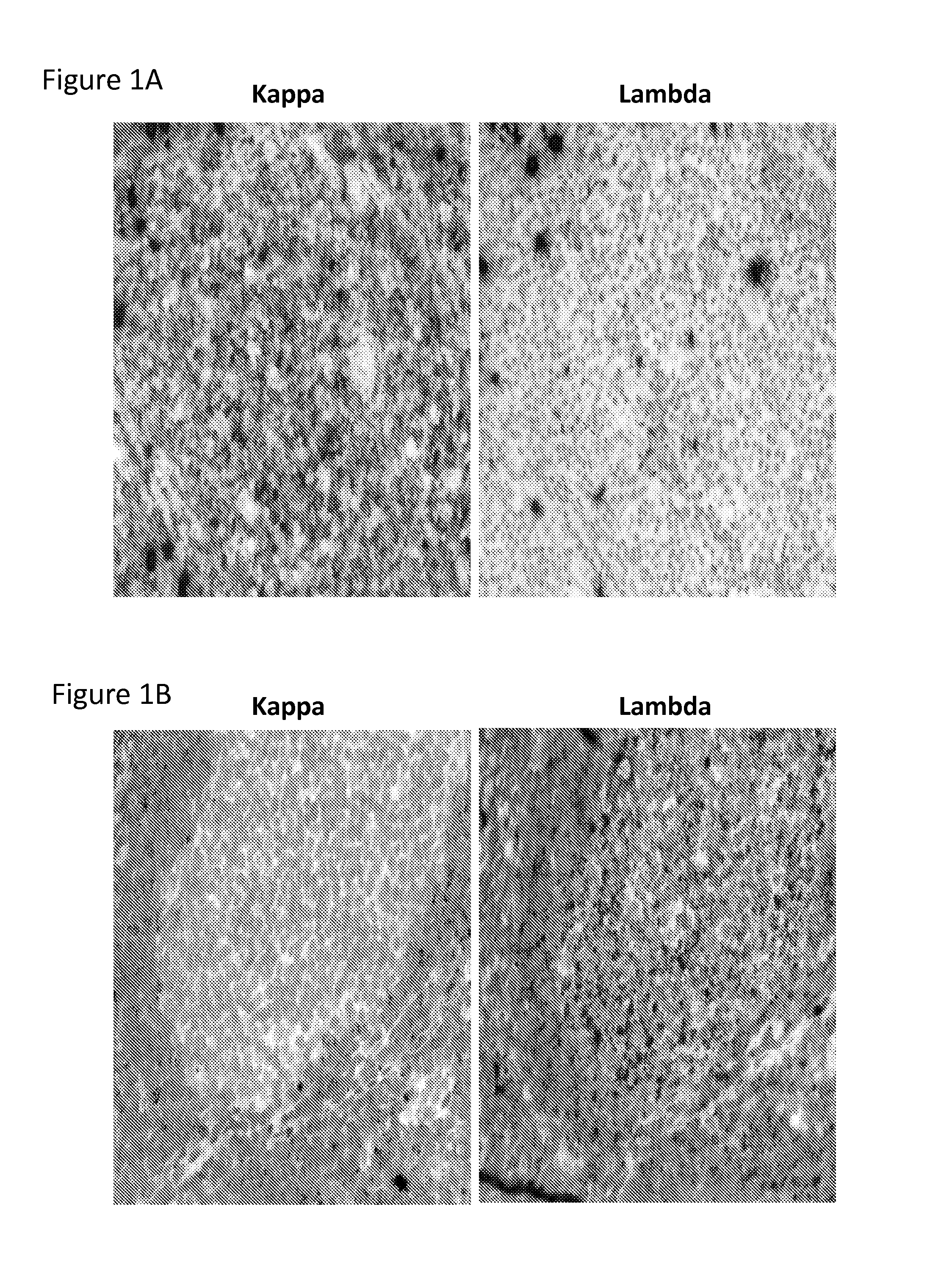 Detection of immunoglobulin light chain restriction by RNA in situ hybridization