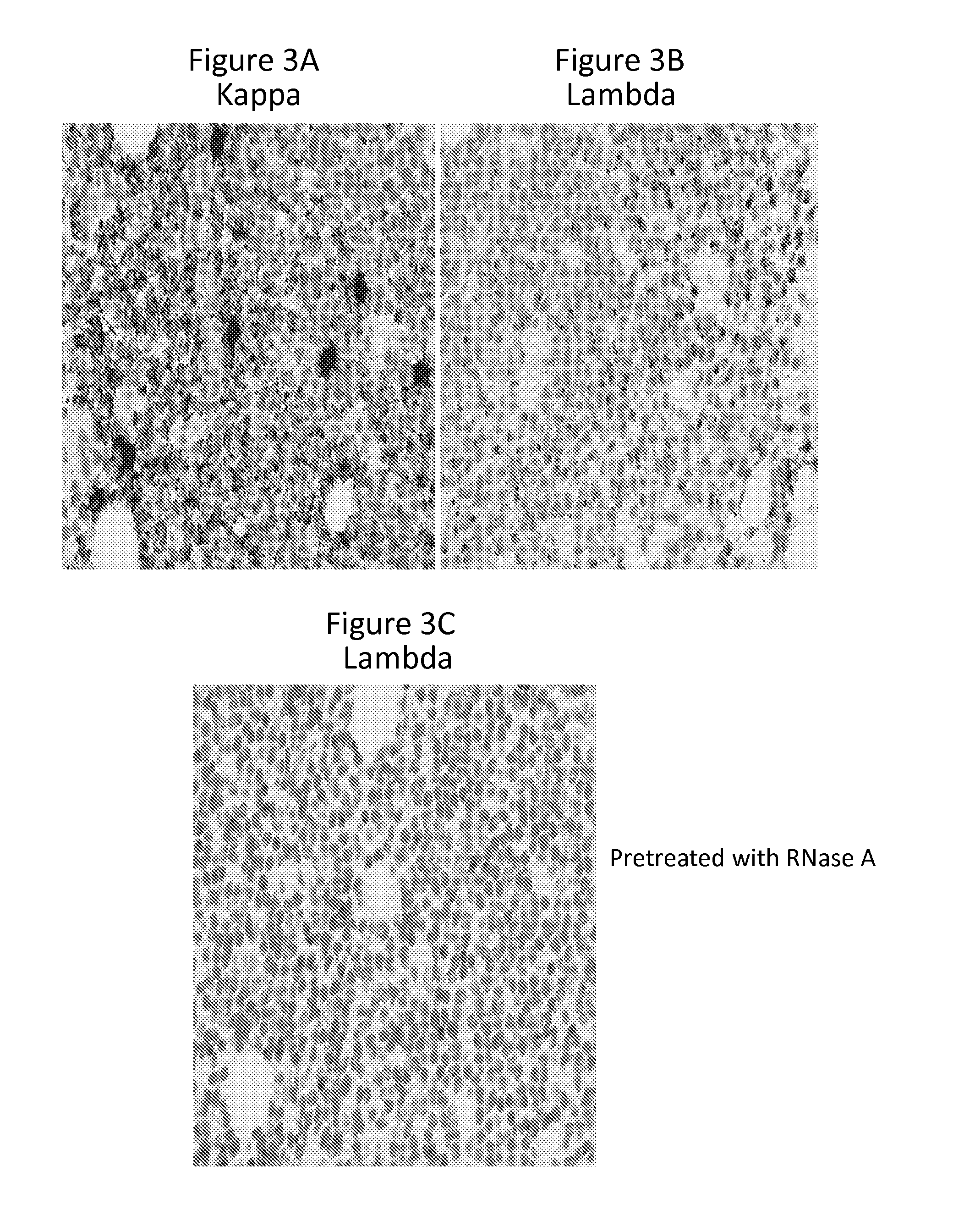 Detection of immunoglobulin light chain restriction by RNA in situ hybridization