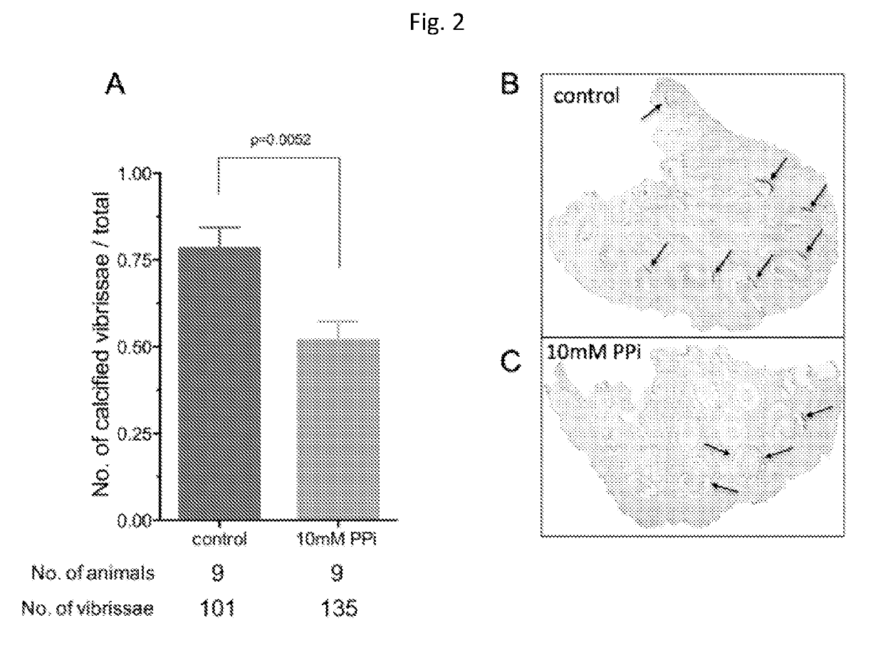 Oral pyrophosphate for use in reducing tissue calcification