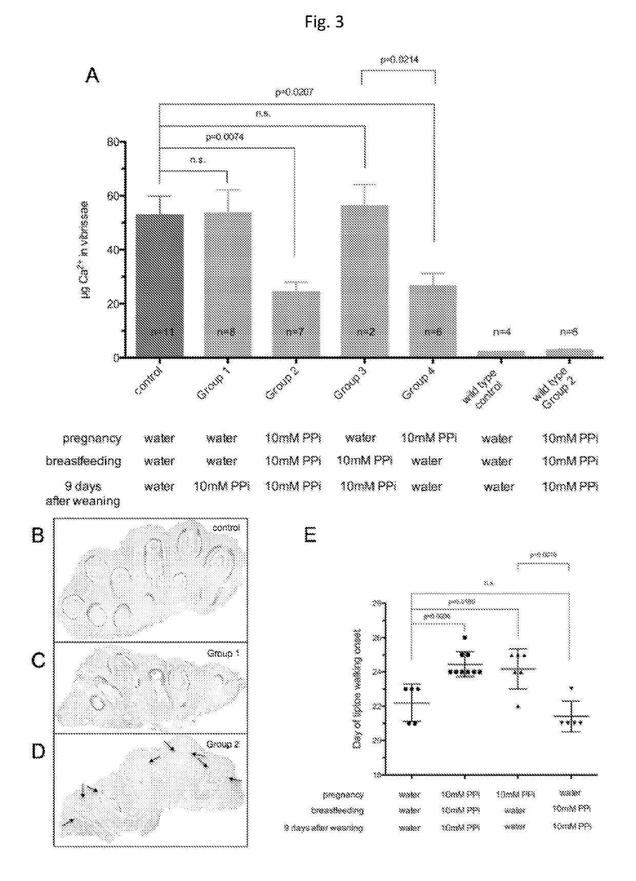 Oral pyrophosphate for use in reducing tissue calcification